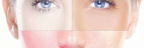 Pigmentation Products