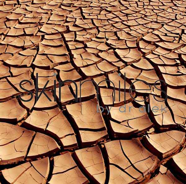 FINE-LINES-AND-WRINKLES-FEATURE-IMAGE-1.jpg-1 FINE-LINES-AND-WRINKLES-FEATURE-IMAGE-1.jpg-1