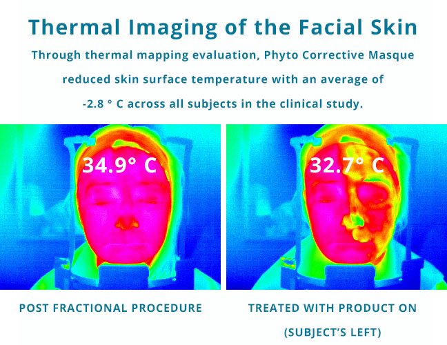 skinceuticals-phyto-corrective-masque-treatment-thermal-image skinceuticals-phyto-corrective-masque-treatment-thermal-image